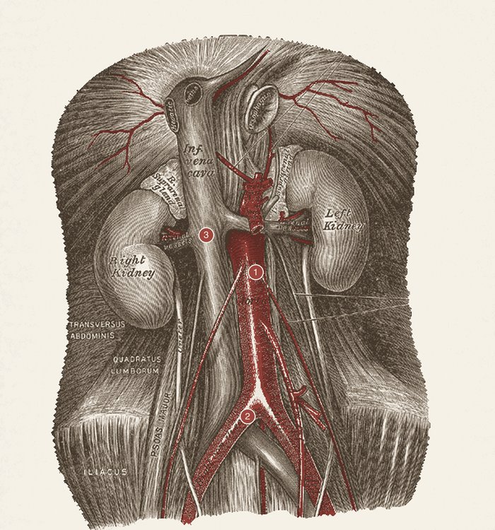 A aorta abdominal e seus ramos — desenho anatômico a grafite sobre papel marfim; em vermelho-óxido, trajeto e ramos. A imagem não traz texto: as estruturas estão na legenda.