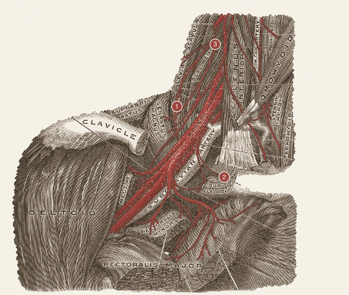 Plexo braquial — desenho anatômico a grafite sobre papel marfim; em vermelho-óxido, topologia raiz a fascículo. A imagem não traz texto: as estruturas estão na legenda.